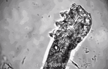 gamophen药皂功效(Gamophen药皂:有效清洁皮肤,预防痤疮)