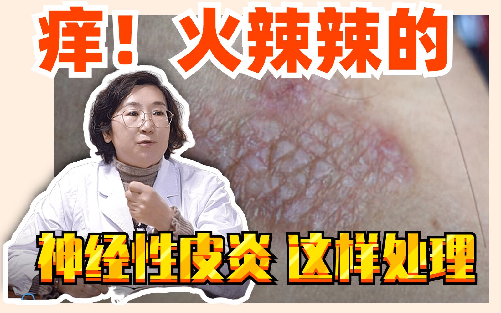 牛黄皮炎灵功效(牛黄皮炎灵:快速缓解皮肤炎症)