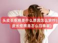 头皮长疙瘩是什么原因怎么治疗(头皮长疙瘩是怎么回事呢)