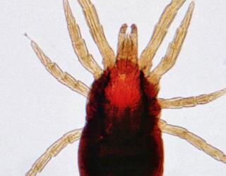 螨虫叮咬是什么样子的(螨虫叮咬是什么样子的感觉)