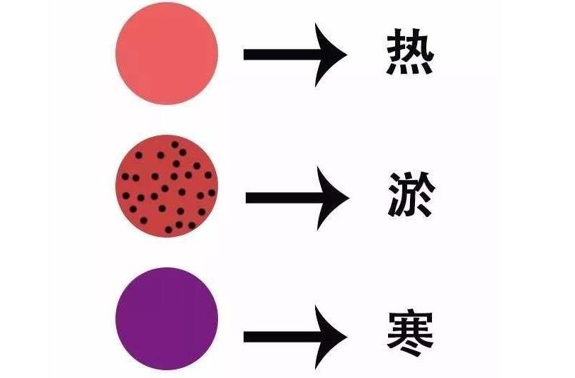 拔罐的颜色代表什么图解(拔罐的颜色代表什么)