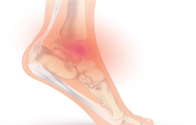 治疗关节扭伤疼痛的精油(包含使用方法)