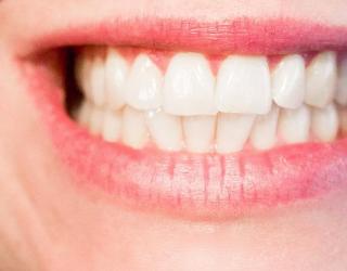 为什么丁香是减轻智齿肿胀的良药？